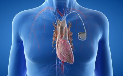 Prof Aisling McMahon and Dr Opeyemi Kolawole present paper on Patents and Medical Devices at Intellectual Property Law Conference in Sheffield University